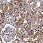 Immunohistochemical staining of human kidney shows moderate to strong nuclear positivity in cells in tubules.