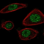 Immunofluorescent staining of human cell line PC-3 shows localization to nucleoplasm.