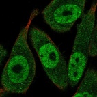 Immunofluorescent staining of human cell line PC-3 shows localization to nucleoplasm & cytosol.