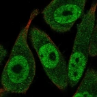 Immunofluorescent staining of human cell line PC-3 shows localization to nucleoplasm & cytosol.