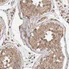 Anti-RAB14 Antibody