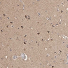 Immunohistochemical staining of human cerebral cortex shows moderate cytoplasmic positivity in neurons.