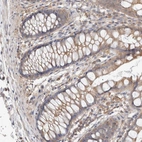 Immunohistochemical staining of human gastrointestinal shows moderate cytoplasmic positivity in glandular cells.