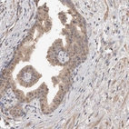 Immunohistochemical staining of human prostate shows moderate cytoplasmic positivity in glandular cells.