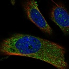 Immunofluorescent staining of human cell line U-251 MG shows localization to vesicles.