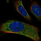 Immunofluorescent staining of human cell line U-251 MG shows localization to vesicles.