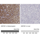 Anti-AKR1B1 Antibody