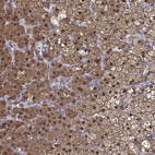 Anti-AKR1B1 Antibody