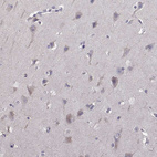 Immunohistochemical staining of human cerebral cortex shows no positivity in neurons as expected.