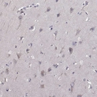Immunohistochemical staining of human cerebral cortex shows no positivity in neurons as expected.