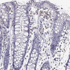 Immunohistochemical staining of human colon shows no positivity in glandular cells as expected.