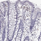 Immunohistochemical staining of human colon shows no positivity in glandular cells as expected.
