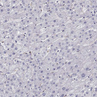 Anti-AKR1B1 Antibody