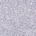 Immunohistochemical staining of human liver shows no positivity in hepatocytes as expected.