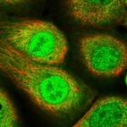Immunofluorescent staining of human cell line A-431 shows localization to nucleoplasm & cytosol.