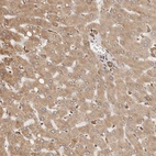 Immunohistochemical staining of human liver shows weak cytoplasmic positivity in hepatocytes.