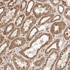 Immunohistochemical staining of human kidney shows moderate cytoplasmic positivity in cells in tubules.