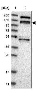 Lane 1: Marker [kDa] 230, 130, 95, 72, 56, 36, 28, 17, 11_br/_Lane 2: Human cell line RT-4