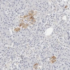 Anti-PKDCC Antibody