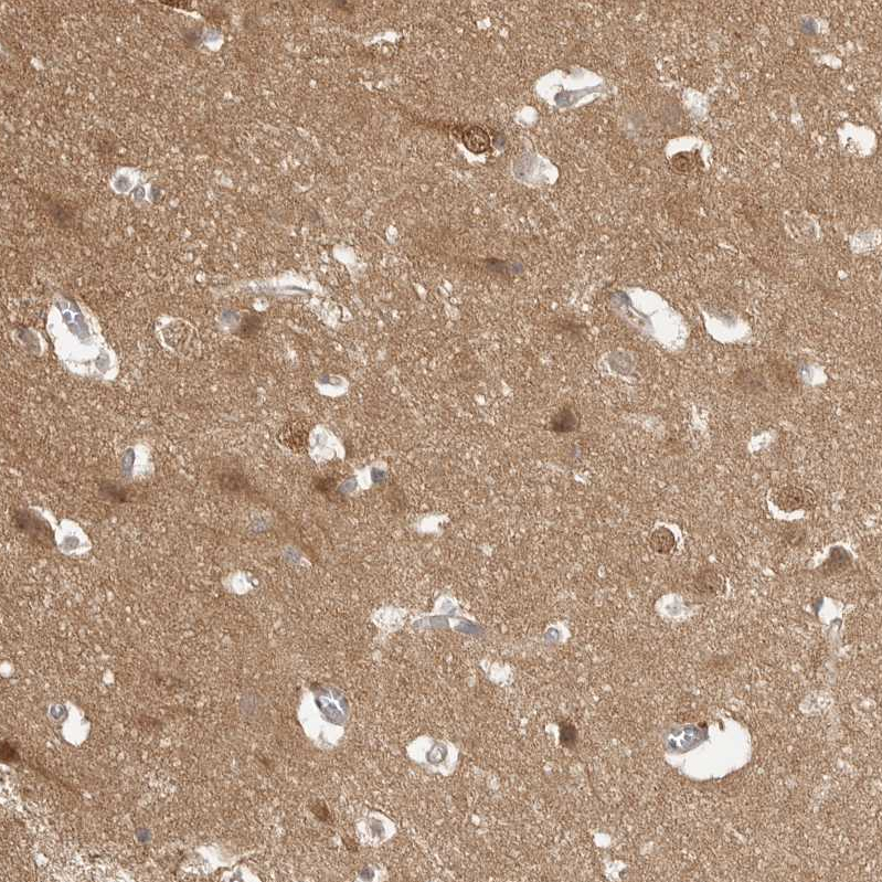 Anti-MAP2K1 Antibody