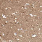 Anti-MAP2K1 Antibody