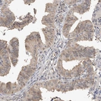 Immunohistochemical staining of human fallopian tube shows moderate cytoplasmic positivity in glandular cells.