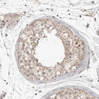 Immunohistochemical staining of human testis shows moderate cytoplasmic positivity in cells in seminiferous ducts.