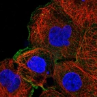 Immunofluorescent staining of human cell line A-431 shows localization to plasma membrane & cytosol.