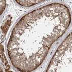 Immunohistochemical staining of human testis shows moderate to strong cytoplasmic positivity in cells in seminiferous ducts.