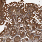 Immunohistochemical staining of human small intestine shows strong cytoplasmic positivity in glandular cells.
