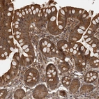 Immunohistochemical staining of human small intestine shows strong cytoplasmic positivity in glandular cells.