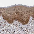 Immunohistochemical staining of human skin shows moderate cytoplasmic positivity in squamous epithelial cells.