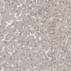 Immunohistochemical staining of human liver shows very weak positivity in hepatocytes as expected.
