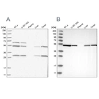 Western blot analysis using Anti-STK24 antibody HPA026435 (A) shows similar pattern to independent antibody HPA026502 (B).
