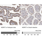 Anti-WDR77 Antibody