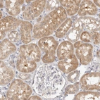 Immunohistochemical staining of human kidney shows moderate cytoplasmic positivity in cells in tubules.