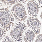 Immunohistochemical staining of human small intestine shows weak cytoplasmic positivity in glandular cells.