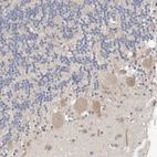 Immunohistochemical staining of human cerebellum shows weak cytoplasmic positivity in Purkinje cells.