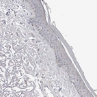 Immunohistochemical staining of human skin shows no positivity in squamous epithelial cells as expected.