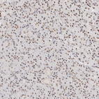 Anti-ZBED6 Antibody