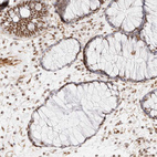Immunohistochemical staining of human colon show strong nuclear positivity in glandular cells.