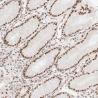 Immunohistochemical staining of human stomach shows strong nuclear positivity in glandular cells.