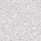 Immunohistochemical staining of human liver shows negative nuclear positivity in hepatocytes as expected.