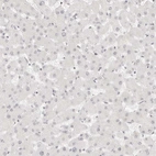 Immunohistochemical staining of human liver shows negative nuclear positivity in hepatocytes as expected.