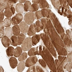 Immunohistochemical staining of human skeletal muscle shows strong cytoplasmic positivity in myocytes.