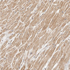 Immunohistochemical staining of human heart muscle shows moderate cytoplasmic positivity in cardiomyocytes.