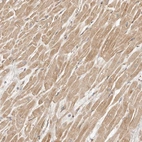 Immunohistochemical staining of human heart muscle shows moderate cytoplasmic positivity in cardiomyocytes.