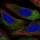 Immunofluorescent staining of human cell line U-2 OS shows localization to cytosol.