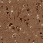 Anti-AKT3 Antibody
