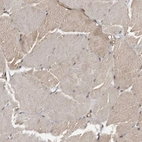 Immunohistochemical staining of human skeletal muscle shows very weak cytoplasmic positivity in myocytes as expected.